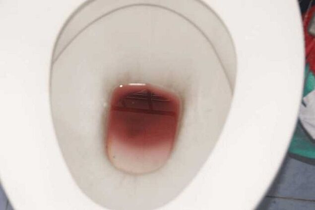 spotting di lalaki nalika bungah